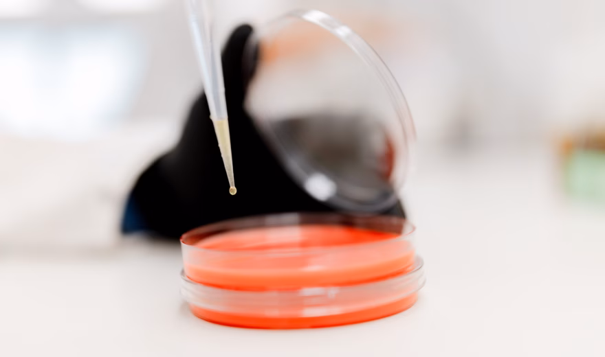 Een vloeistofmonster wordt met een pipet toegevoegd aan een petrischaal voor laboratoriumonderzoek.